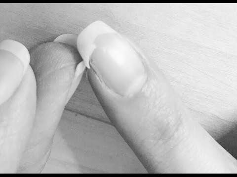 How do you fix a broken fingernail? photo 1