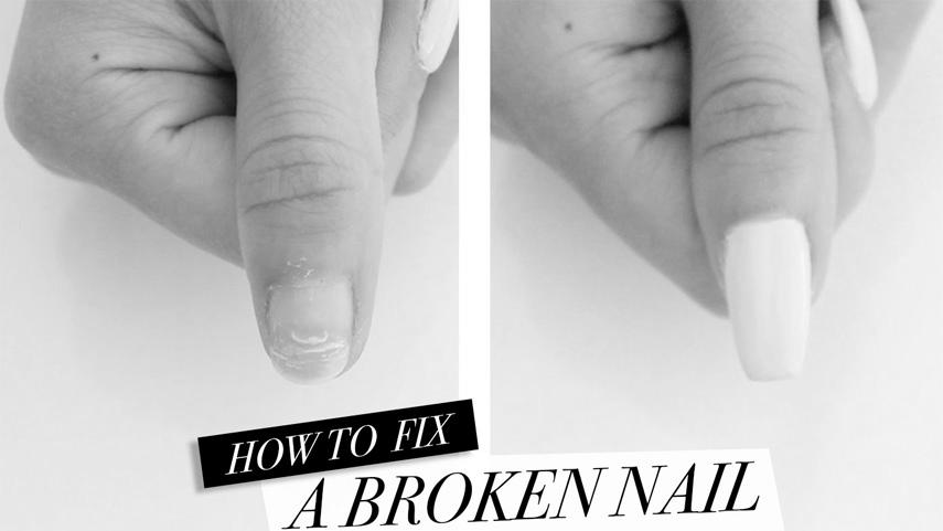 How do you fix a broken fingernail? image 0