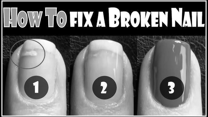 How do you fix a broken fingernail? image 2