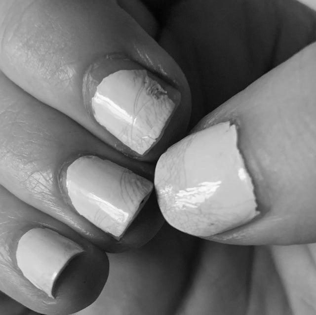 How do I prevent my nails from cracking? image 6