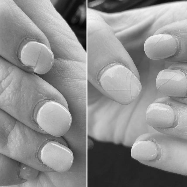 How do I prevent my nails from cracking? image 12