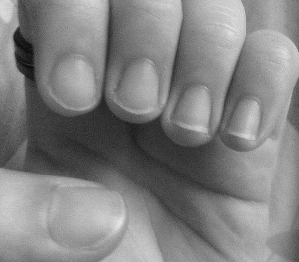 How do I get a half-moon (Lunula) back on my nails? photo 3