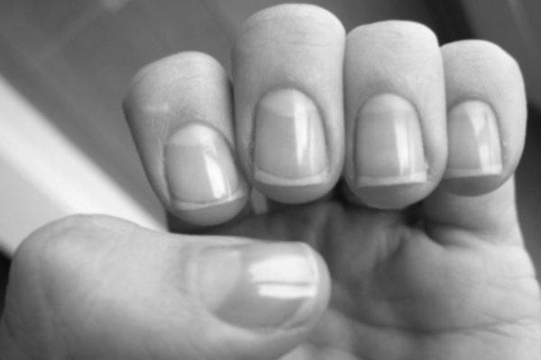 How do I get a half-moon (Lunula) back on my nails? photo 14