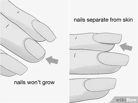 How can one strengthen weak, brittle nails? image 8