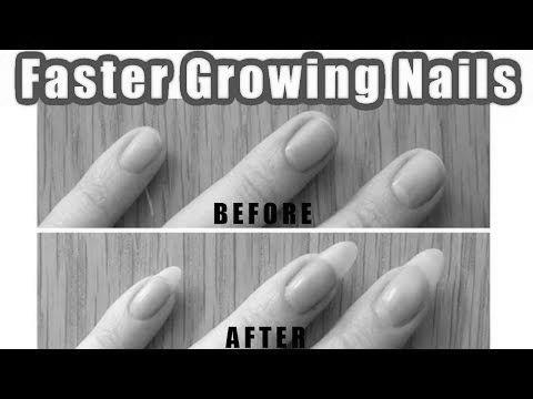 Why do my nails grow overnight? photo 9