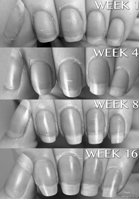 Why do my nails grow overnight? photo 11