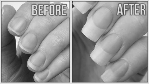 Does the toothpaste help nails to grow? image 10