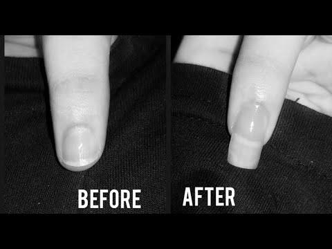 Does the toothpaste help nails to grow? photo 0