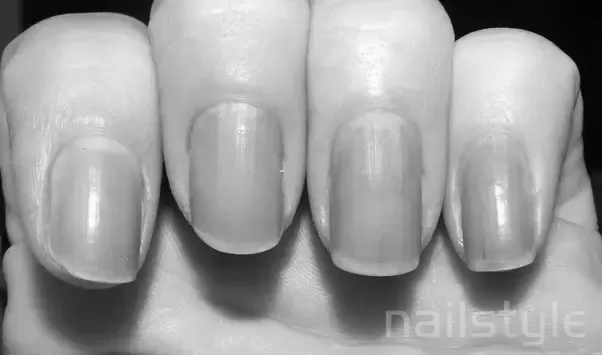 Is nail polish bad for nails? image 1