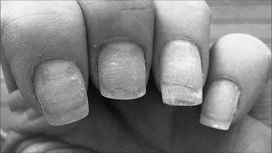 Is nail polish bad for nails? image 13