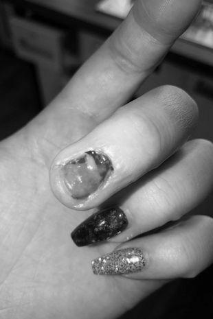 What occurs during a manicure? Does it hurt? image 6