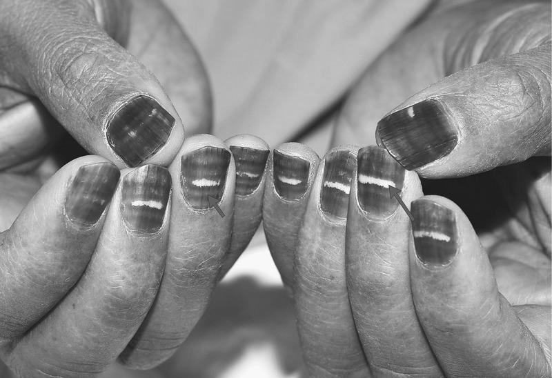How do I treat my nails as a man? image 3