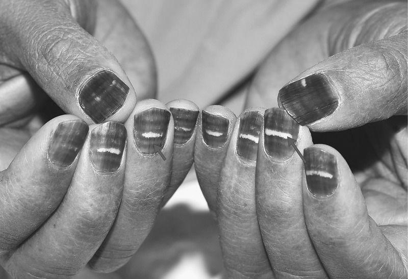 How do I treat my nails as a man? image 5