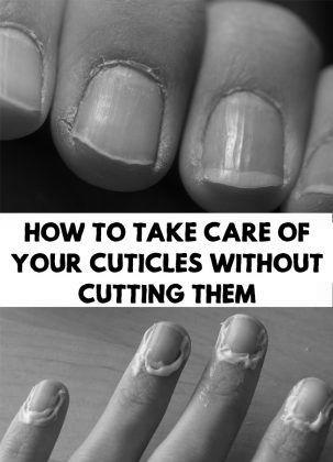 What do you do to care for your cuticles? photo 11