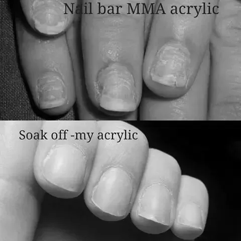 Do acrylic nails ruin your real nails for years? photo 4
