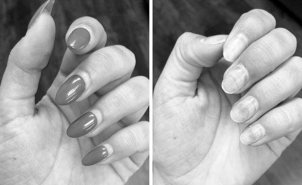 Do acrylic nails ruin your real nails for years? photo 9