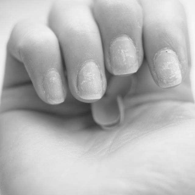 How to take care of brittle nails? photo 1