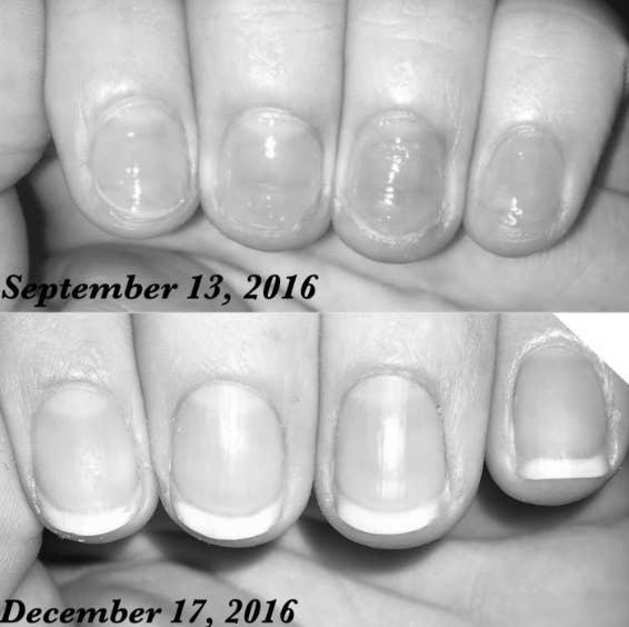 How do I treat my nails to make them stronger? image 2