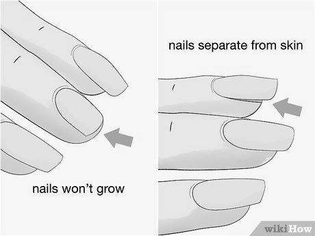 How do I treat my nails to make them stronger? image 8