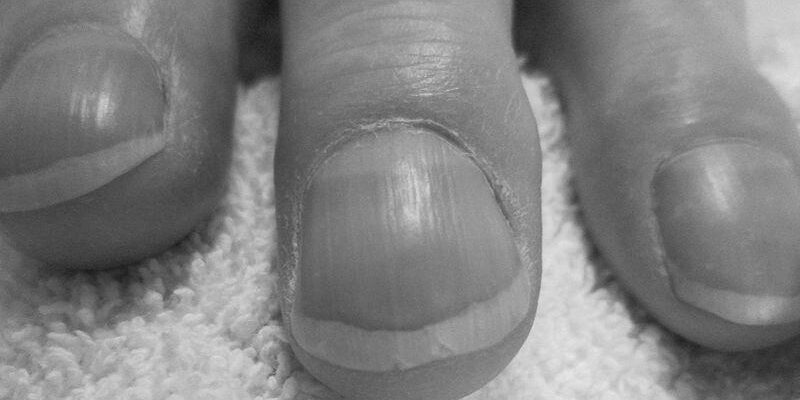 Is nails condition shows tells about our health? image 0