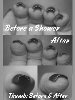 Why do my fingernails get weak after I shower? photo 0