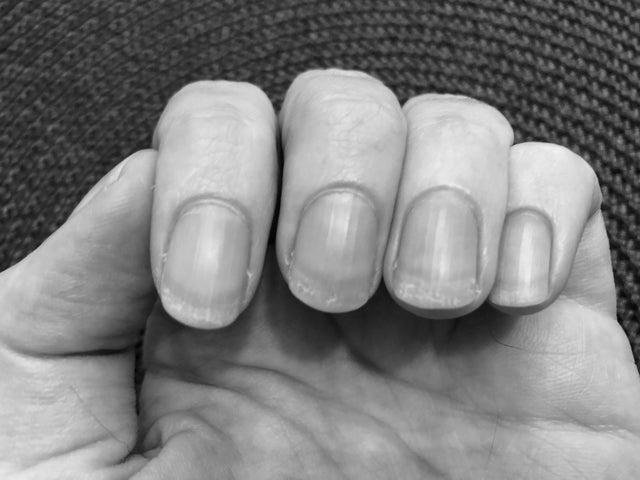 Why do my fingernails get weak after I shower? photo 1