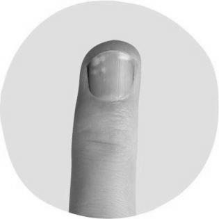 How to improve my nail health? image 8