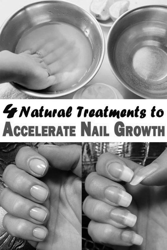 How do you help your nails grow more quickly in a week? image 12