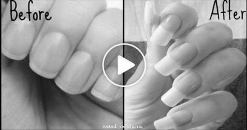 How do you help your nails grow more quickly in a week? image 14