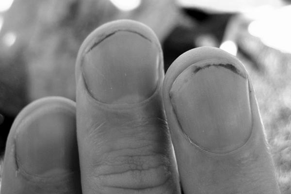Do fingernails grow faster when you work with dirt a lot? image 4