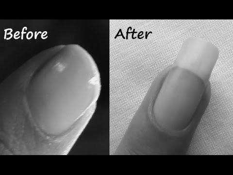 Why do my nails grow overnight? photo 7