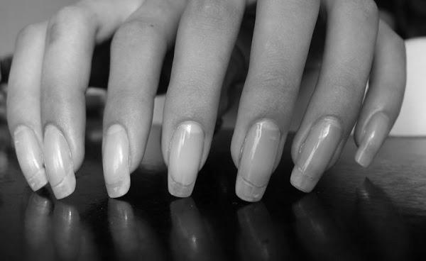 How to make my nails grow faster and stronger? photo 5