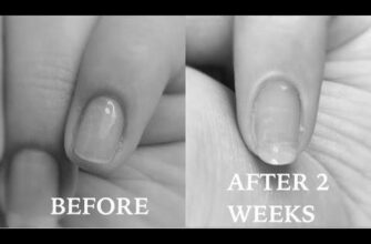 How do I grow my nails in 2 weeks? image 0
