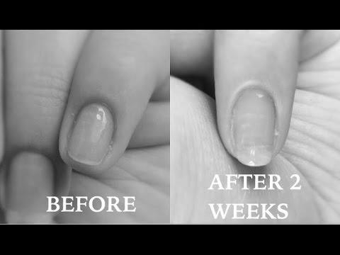 How do I grow my nails in 2 weeks? image 0