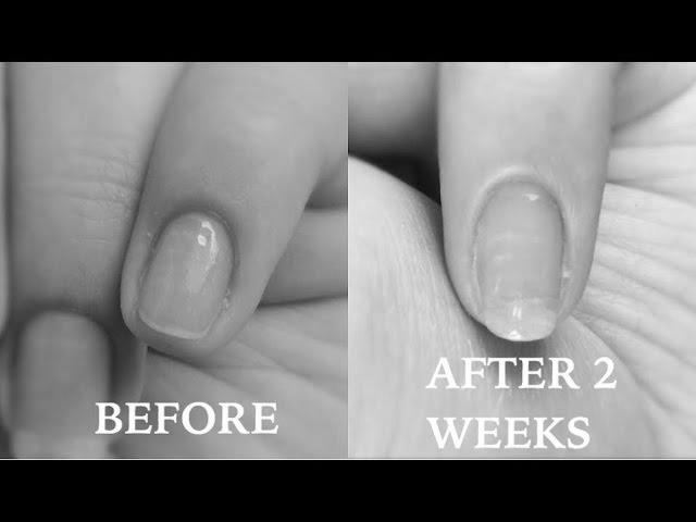How do I grow my nails in 2 weeks? image 2