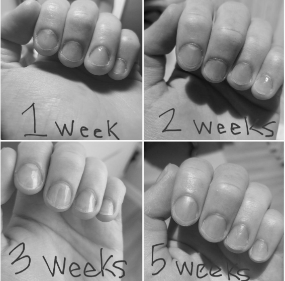 How do I grow my nails in 2 weeks? image 6