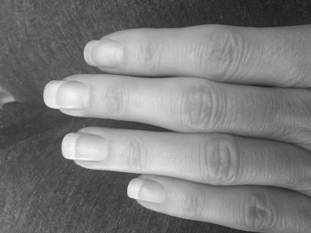 How long would a typical fingernail grow in a lifetime? photo 5