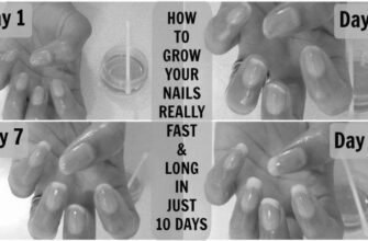 Can garlic really help your nails grow? image 0