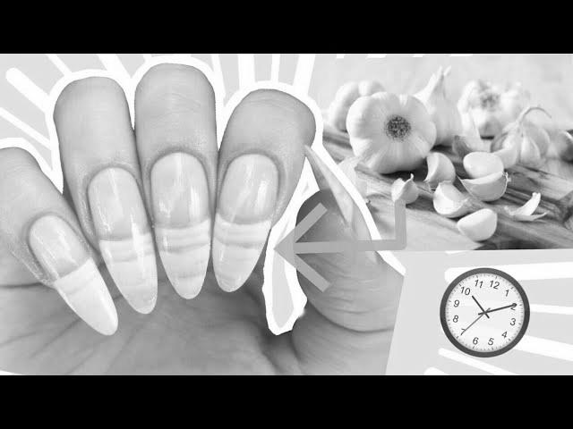 Can garlic really help your nails grow? image 2