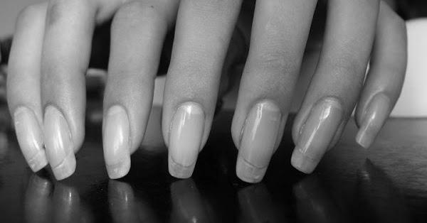 Can garlic really help your nails grow? image 5