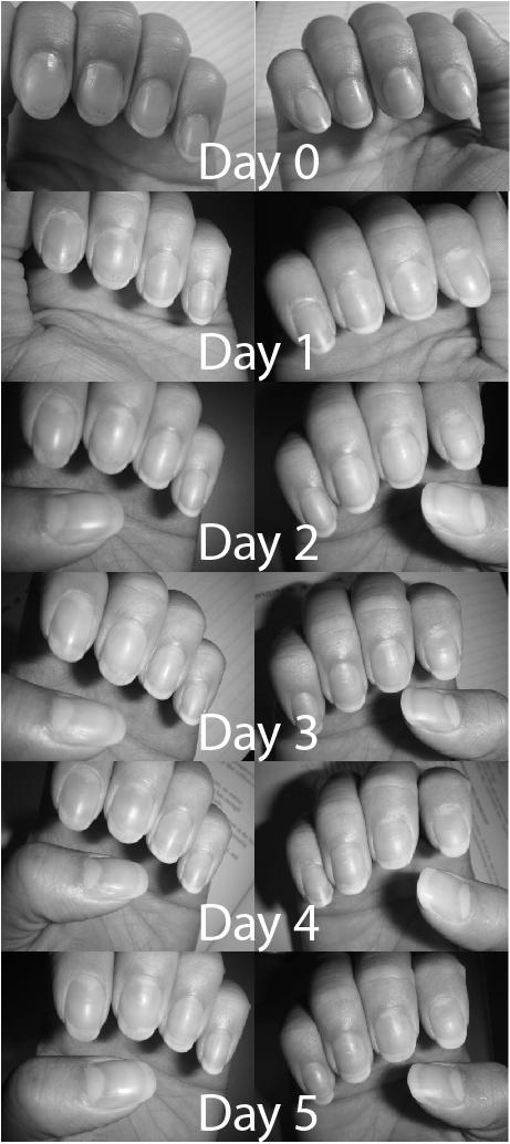 How much do fingernails grow in a day ? image 0