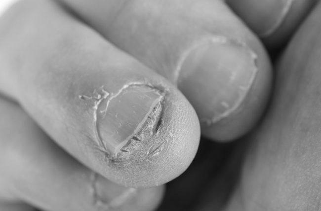 How far back under your skin do your fingernails grow? image 3