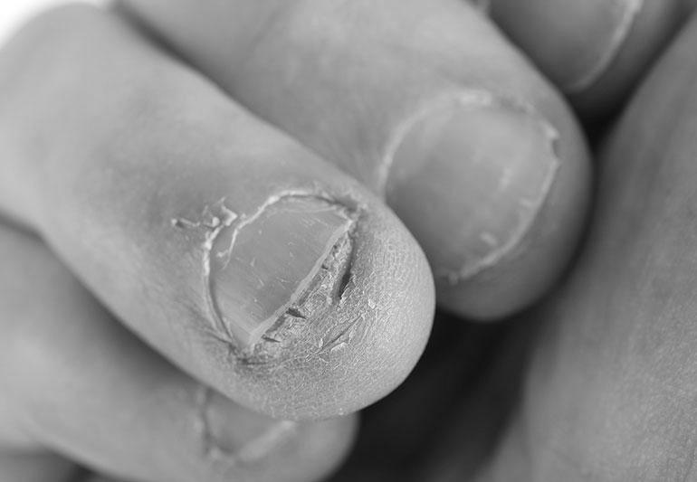 How far back under your skin do your fingernails grow? image 9