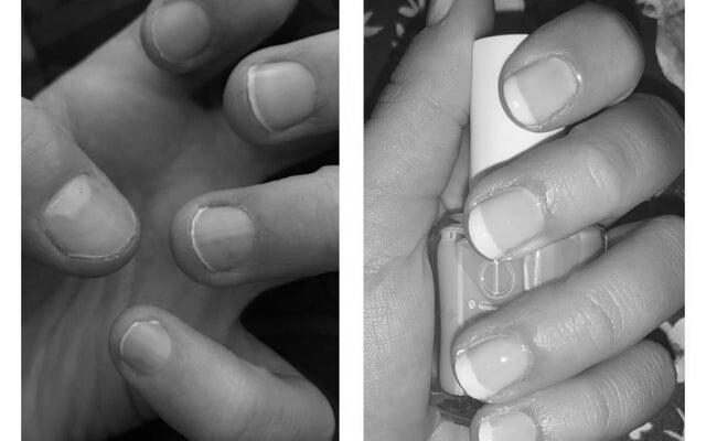How do I grow my nails from nothing? image 0