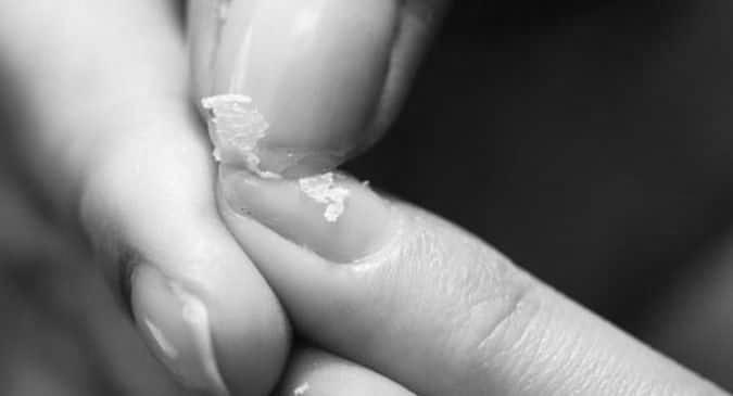 How can one strengthen weak, brittle nails? photo 7