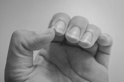 How can one strengthen weak, brittle nails? photo 8