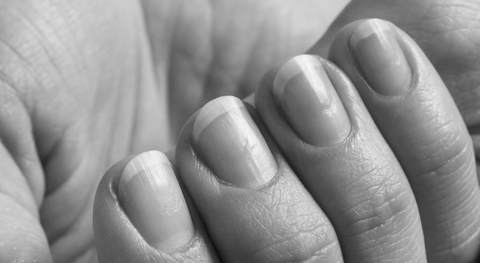 What vitamin are you lacking when your nails split? image 0