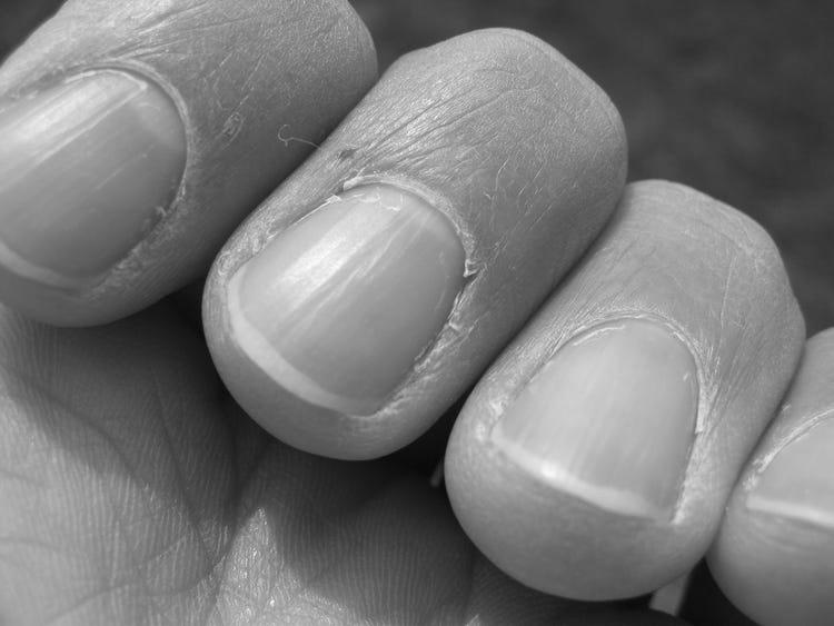 How do I have good nails? image 2