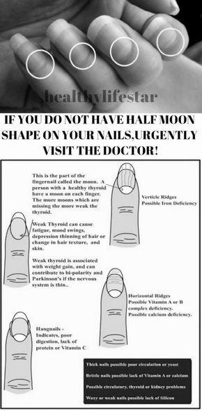 How do I get a half-moon (Lunula) back on my nails? image 6