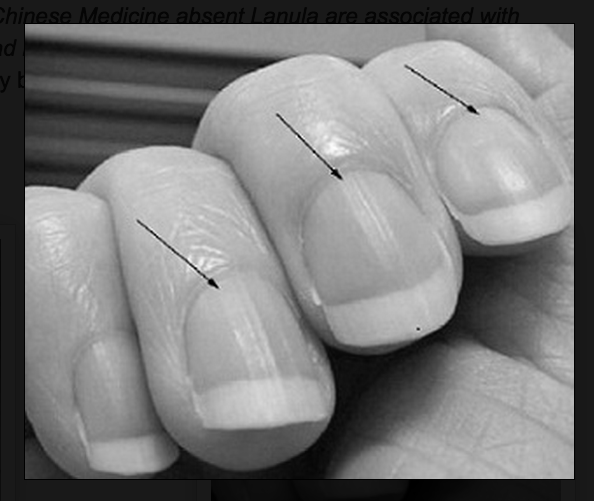 How do I get a half-moon (Lunula) back on my nails? image 7